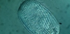 Spathidiopsis socialis