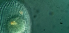 Spathidiopsis socialis