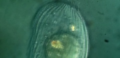 Spathidiopsis socialis