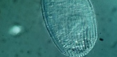 Spathidiopsis socialis