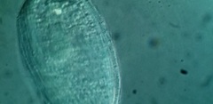 Spathidiopsis socialis