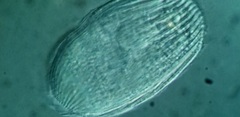 Spathidiopsis socialis