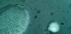 Spathidiopsis socialis