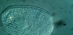 Spathidiopsis socialis