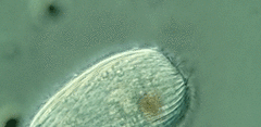 Spathidiopsis socialis