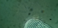 Spathidiopsis socialis
