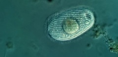 Spathidiopsis socialis