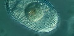 Spathidiopsis socialis