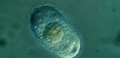 Spathidiopsis socialis