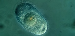Spathidiopsis socialis