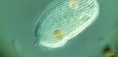 Spathidiopsis socialis