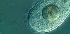 Spathidiopsis socialis