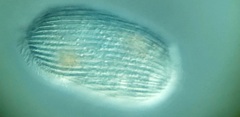 Spathidiopsis socialis