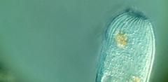 Spathidiopsis socialis