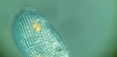 Spathidiopsis socialis