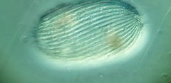 Spathidiopsis socialis