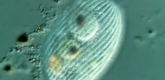 Spathidiopsis socialis