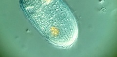 Spathidiopsis socialis