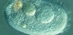 Spathidiopsis socialis