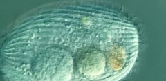 Spathidiopsis socialis