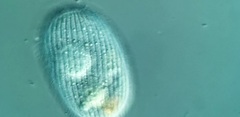 Spathidiopsis socialis