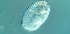 Spathidiopsis socialis