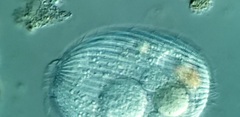 Spathidiopsis socialis