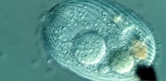 Spathidiopsis socialis