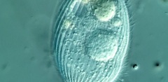 Spathidiopsis socialis