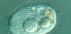 Spathidiopsis socialis