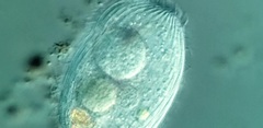 Spathidiopsis socialis