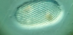 Spathidiopsis socialis