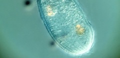 Spathidiopsis socialis