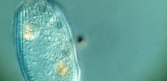 Spathidiopsis socialis
