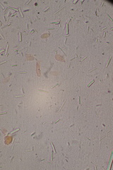 Fibulomyces mutabilis