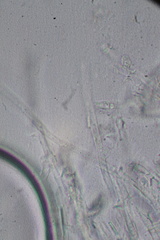 Fibulomyces mutabilis