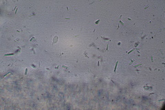 Fibulomyces mutabilis