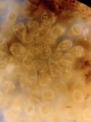 Campanella