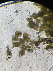 Campanella
