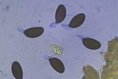 Podospora excentrica