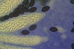 Podospora ampullacea