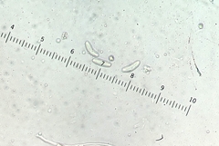 Sclerencoelia