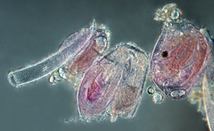 Synchytrium papillatum