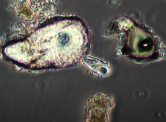 Euglypha filifera