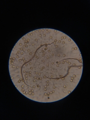 Trichia botrytis