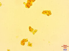 Ossicaulis lachnopus