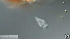 Vorticella infusionum