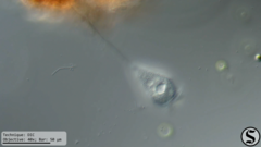 Vorticella infusionum