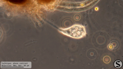 Vorticella infusionum