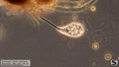 Vorticella infusionum